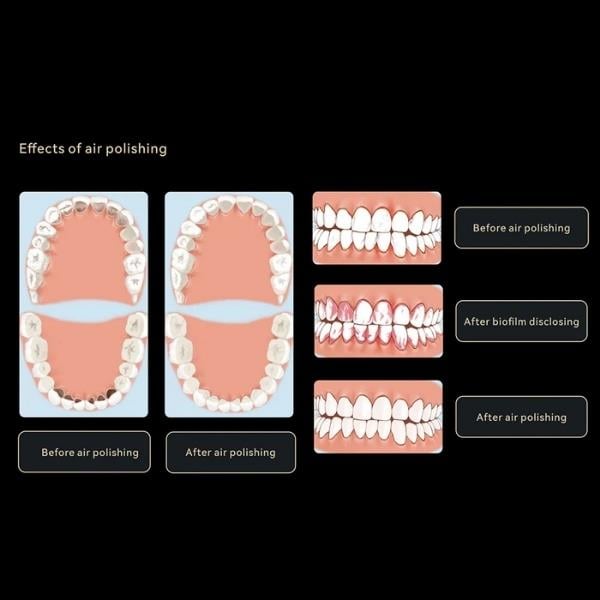 Woodpecker Gentle Air Flow Tozu 200 gr