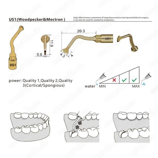 Woodpecker US1 Ultrasurgery Kemik Kesme Ucu
