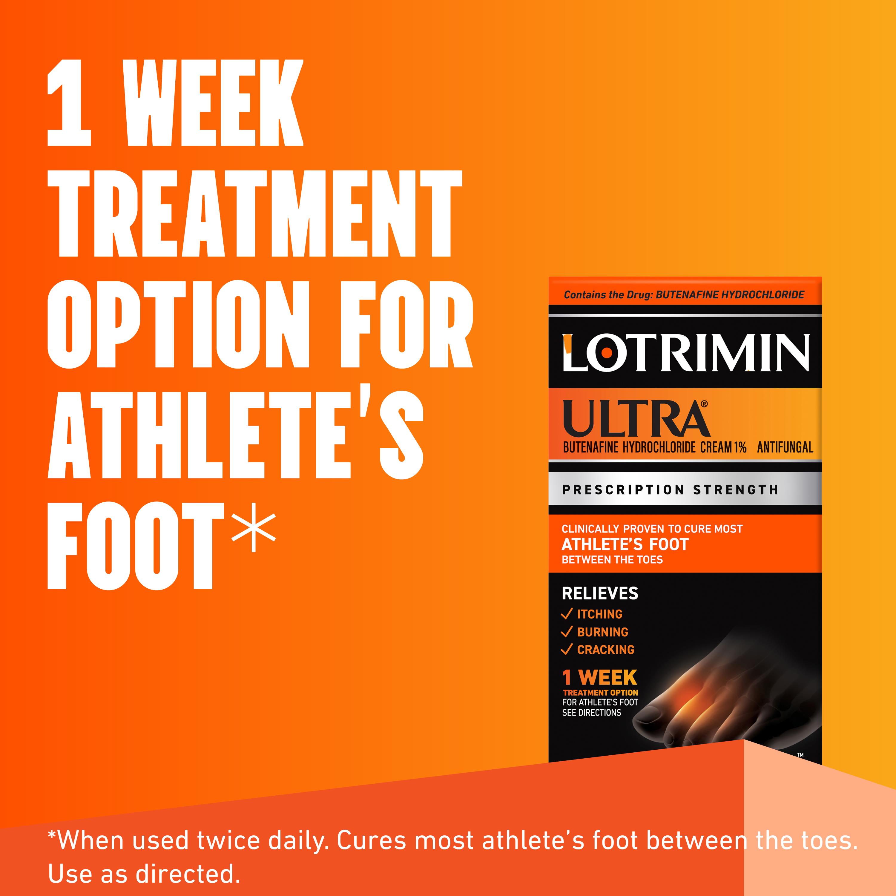 Lotrimin Ultra 1 Hafta Ayak Mantarı Bakımı Antifungal Krem 15G