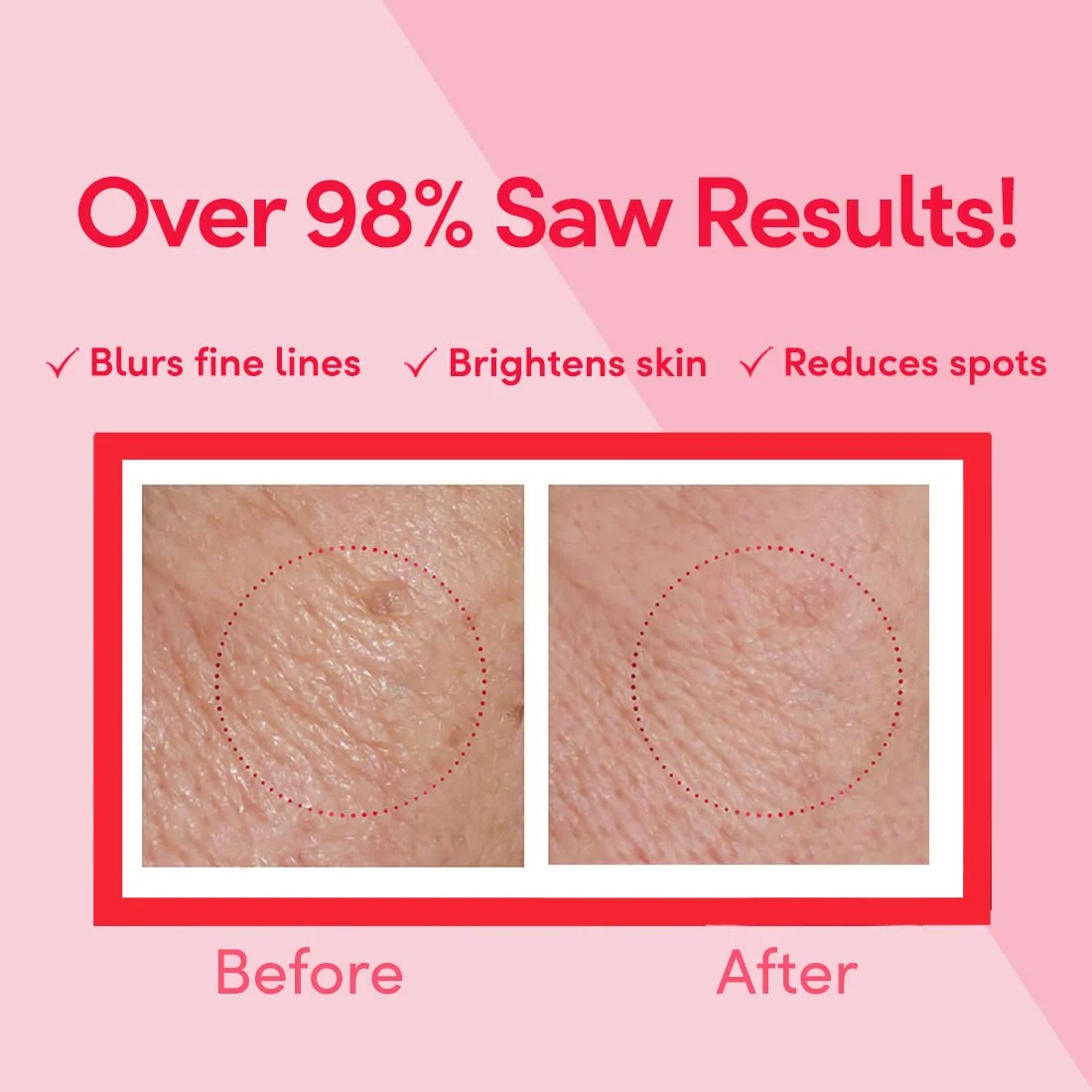 Ponds Age Miracle Wrinkle Kırışıklık Düzeltici Gündüz Kremi 50Gr 
