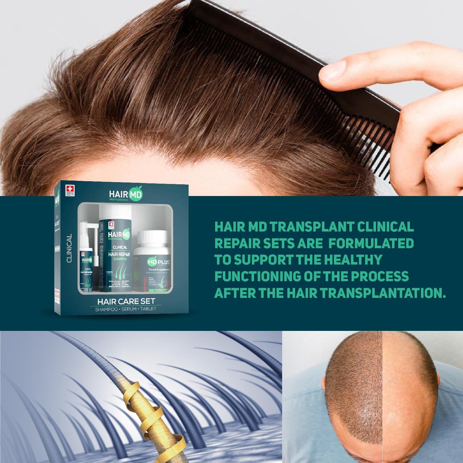Hairmd Clinical Hair Repair Set 1 Months Use (1 Shampoo 250 Ml  + 1 Tablet + 1 Serum)