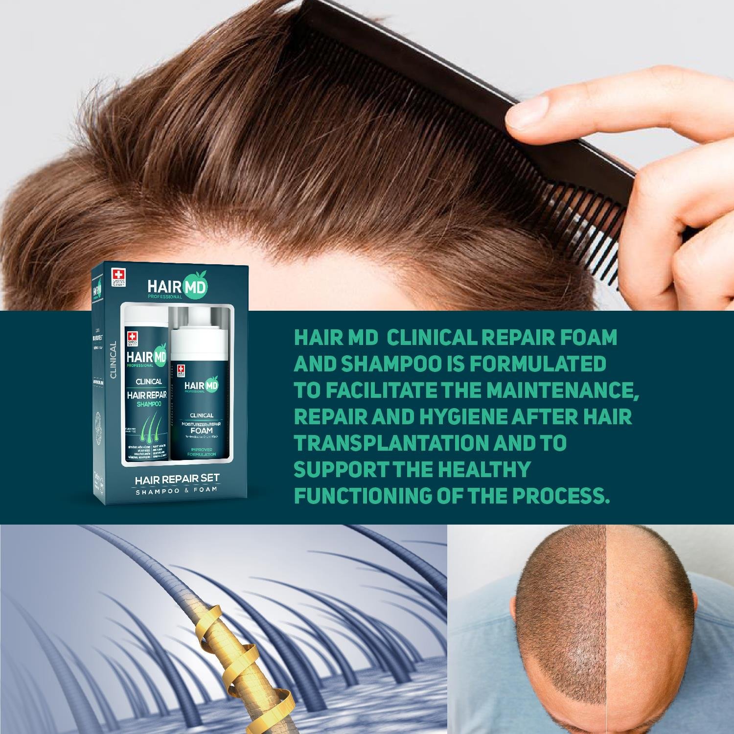 Hairmd Clinical Hair Repair Set ( 100 Ml Shampoo + 100 Ml Repair Foam )