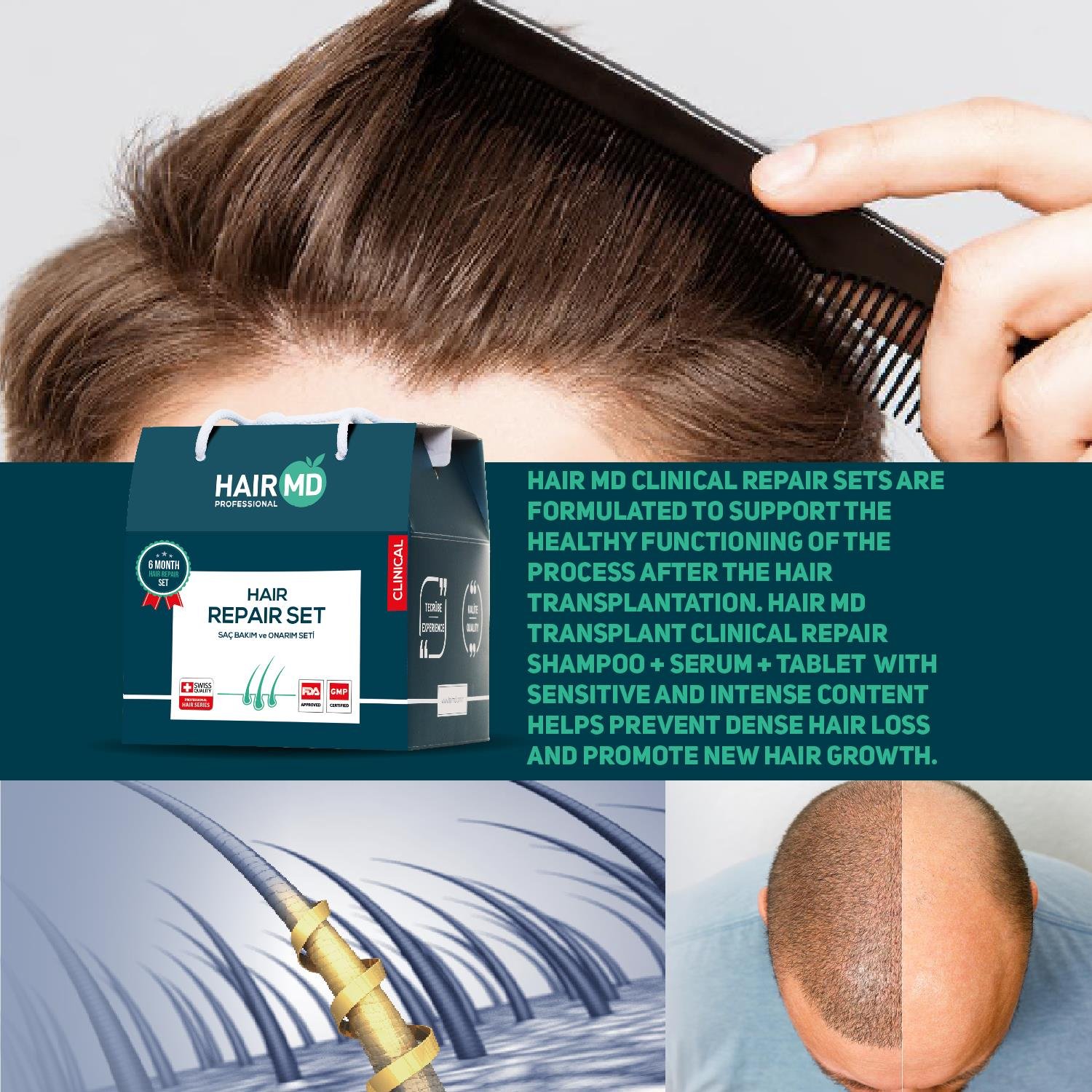 Hairmd Clinical Hair Repair Set 6 Months Use (6 Shampoo 250 Ml  + 6 Serum + 6 Tablet)