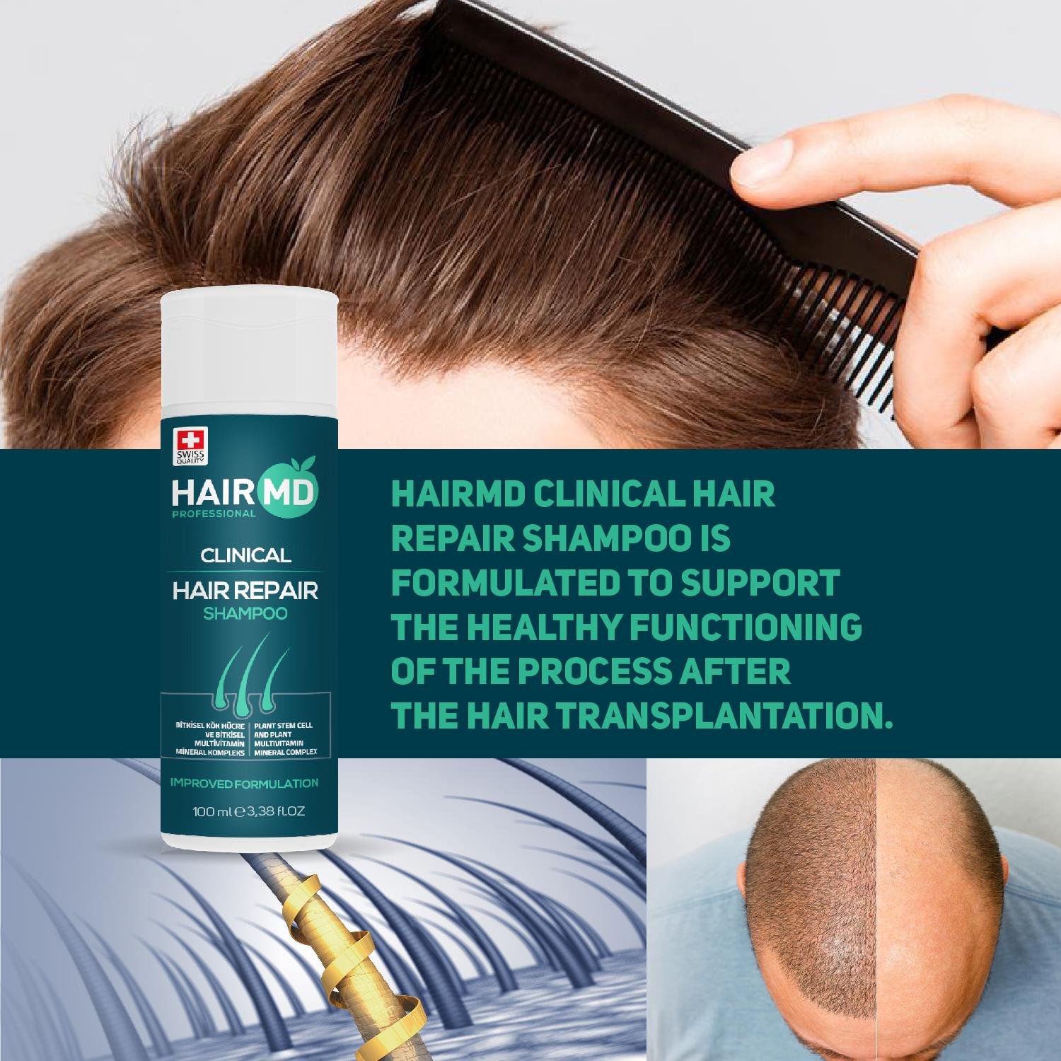 Hairmd Clinical Hair Repair Shampoo 100 Ml 