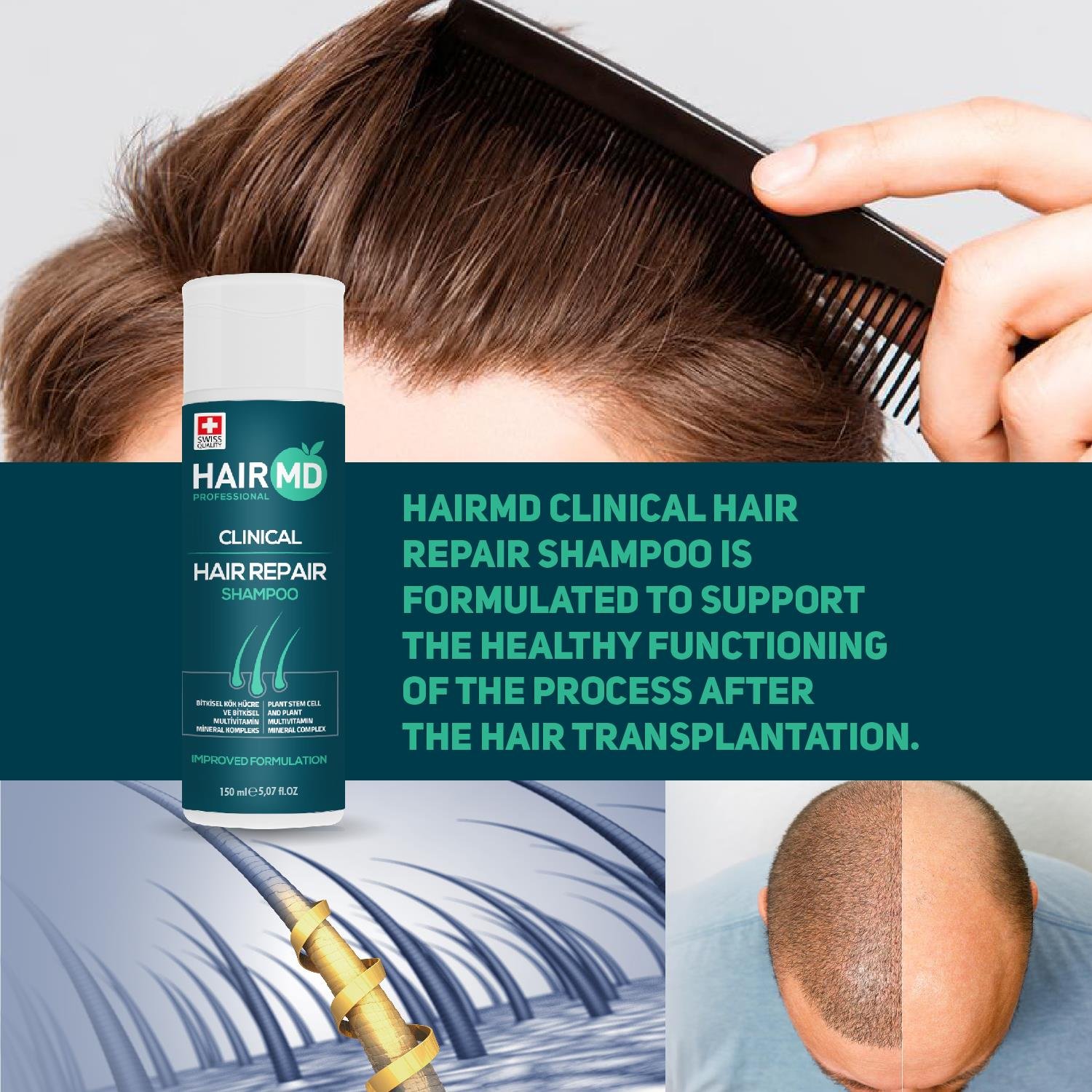 Hairmd Clinical Hair Repair Shampoo 150 Ml 