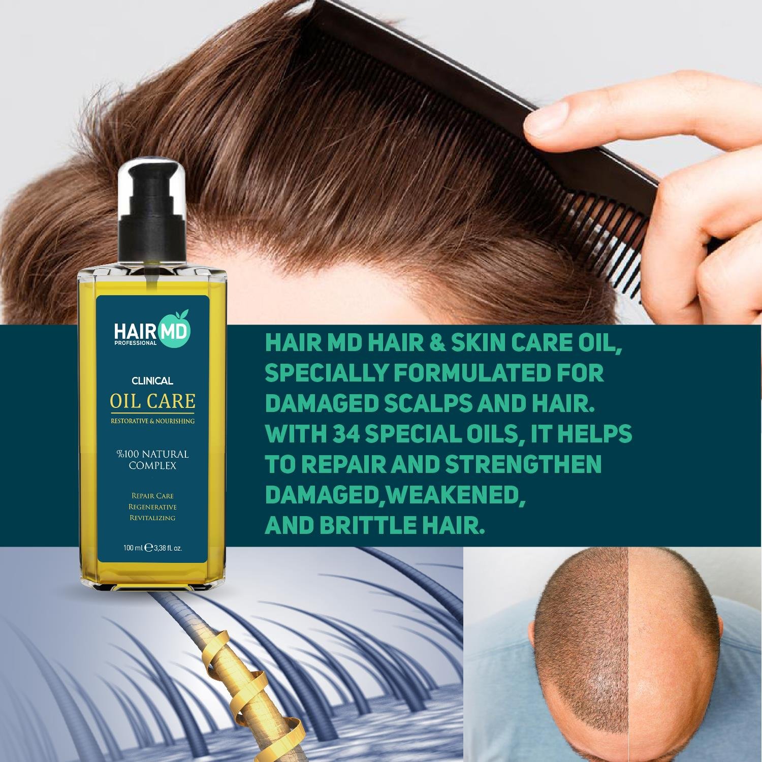 Hairmd Clinical Restorative Nourishing Oil Care 100 Ml
