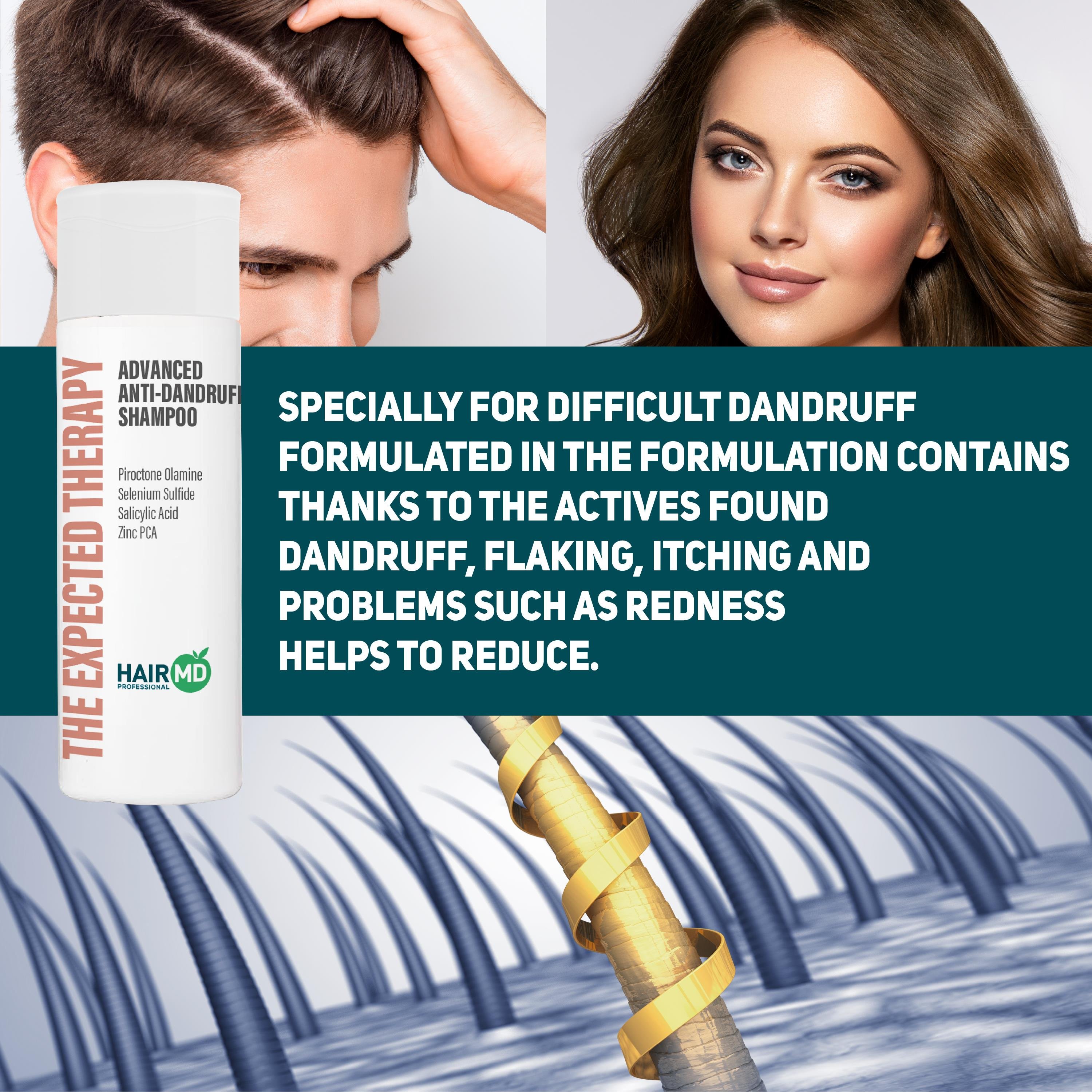 Hairmd Tet The Expert Therapy Anti Dandruff  Shampoo 200 Ml