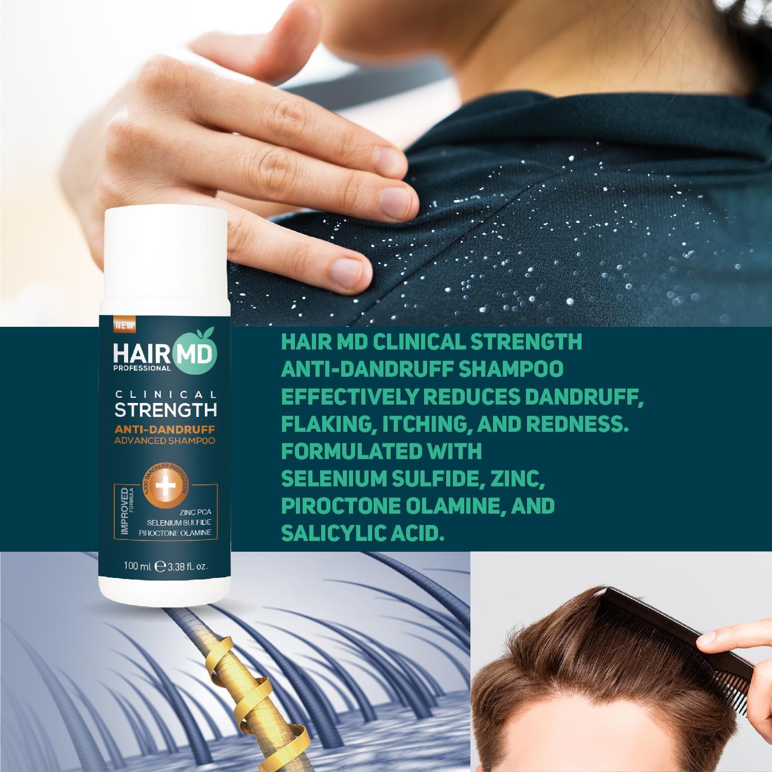 Hairmd Clinical Advanced Dandruff Shampoo 100 Ml