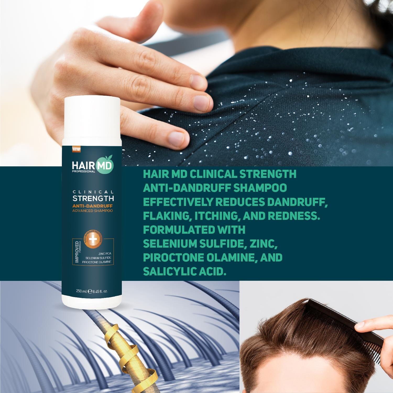 Hairmd Clinical Advanced Dandruff Shampoo 250 Ml