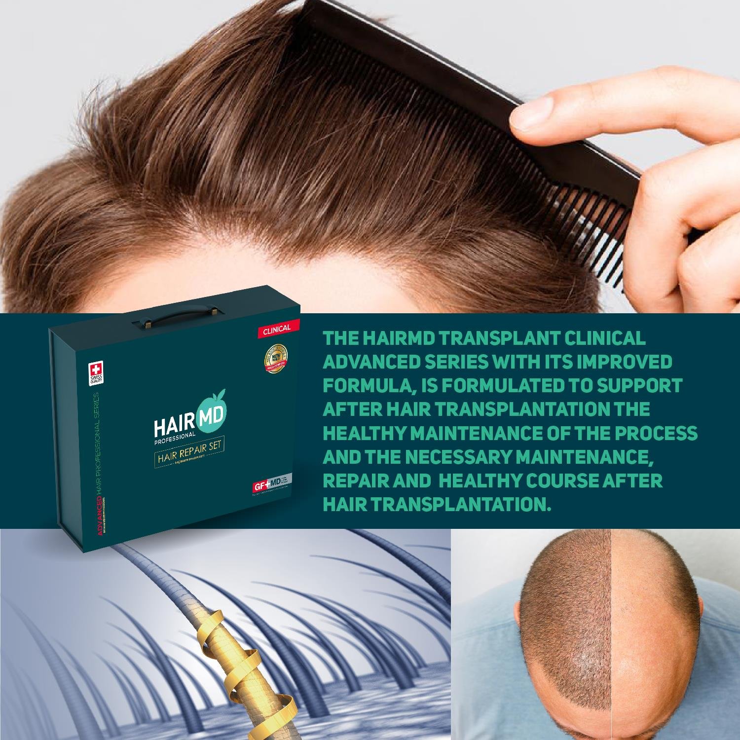 Hairmd Clinical Advanced Hair Repair Set 3 Months Use Bond Bag (3 Shampoo 250 Ml  + 3 Serum + 3 Tablet + 5 Flakon Meso Serum) 