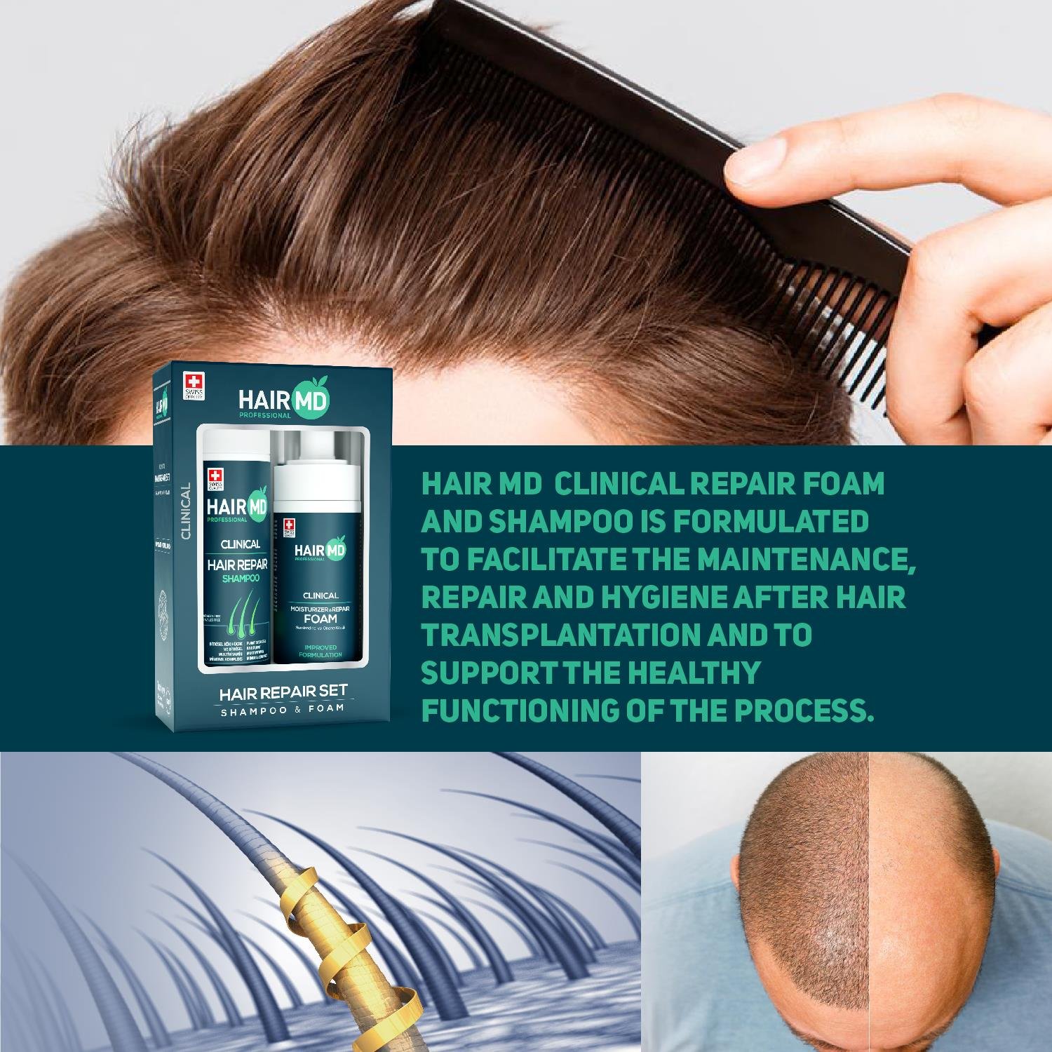 Hairmd Clinical Hair Repair Set ( 250 Ml Shampoo + 150 Ml Repair Foam )