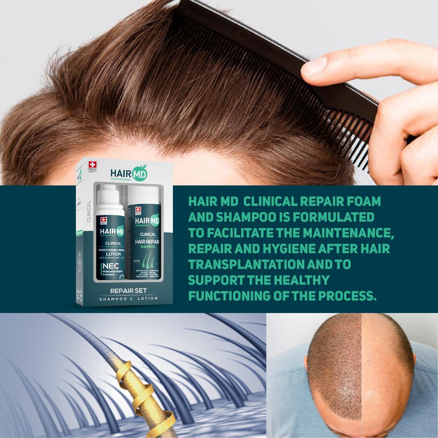 Hairmd Clinical Hair Repair Set ( 250 Ml Shampoo + 125 Ml Nec Lotion )