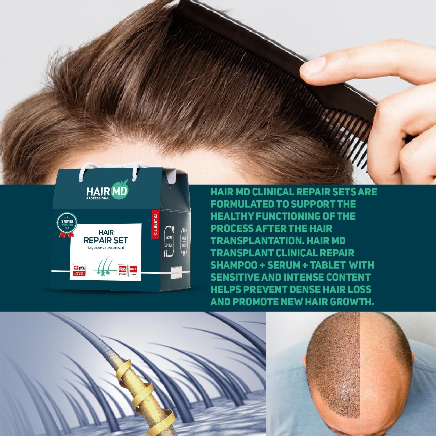 Hairmd Clinical Hair Repair Set 3 Months Use (3 Shampoo 250 Ml  +  3 Serum + 3 Tablet)