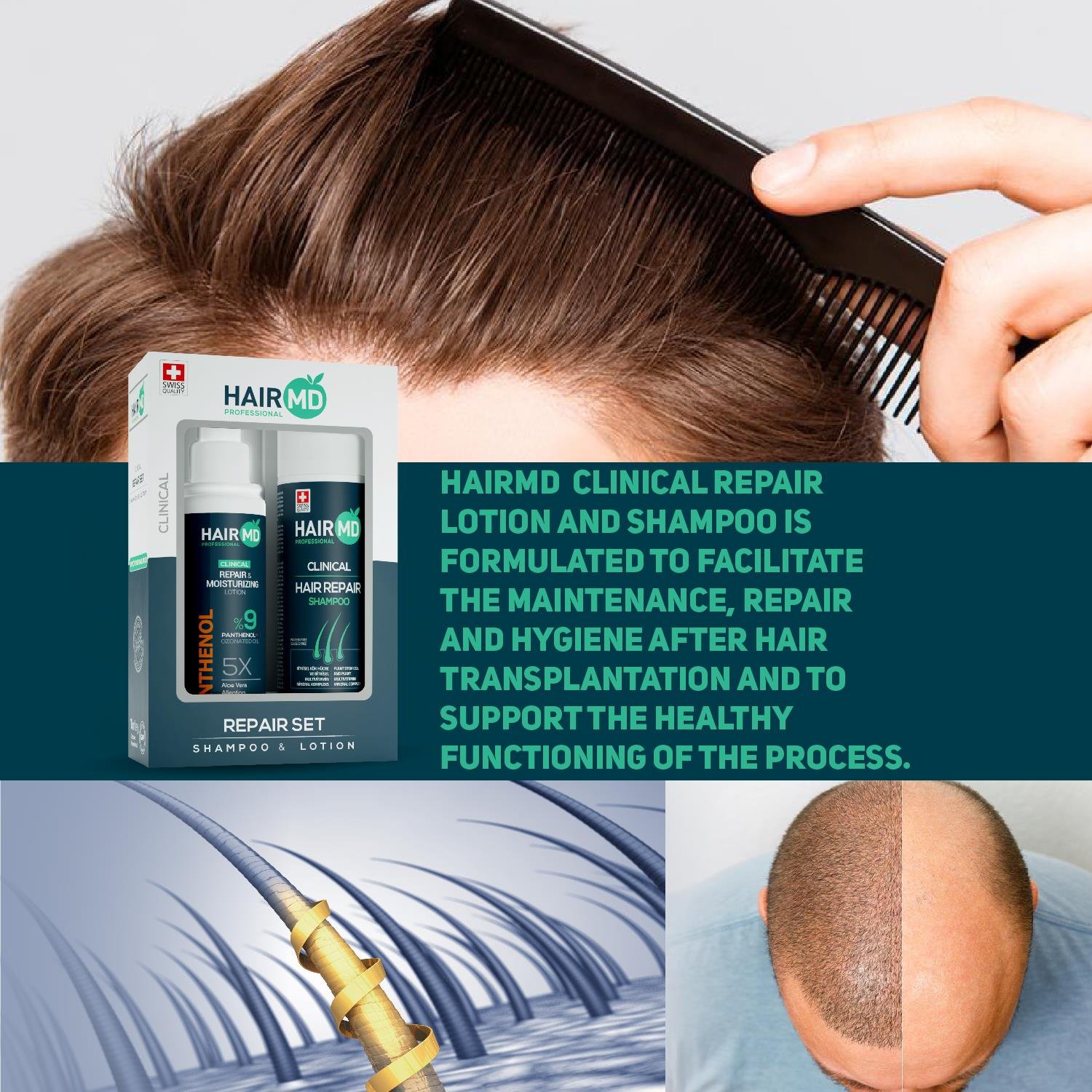 Hairmd Clinical Hair Repair Set (Shampoo 100 Ml + Panthenol % 9 Lotion 100 Ml ) 