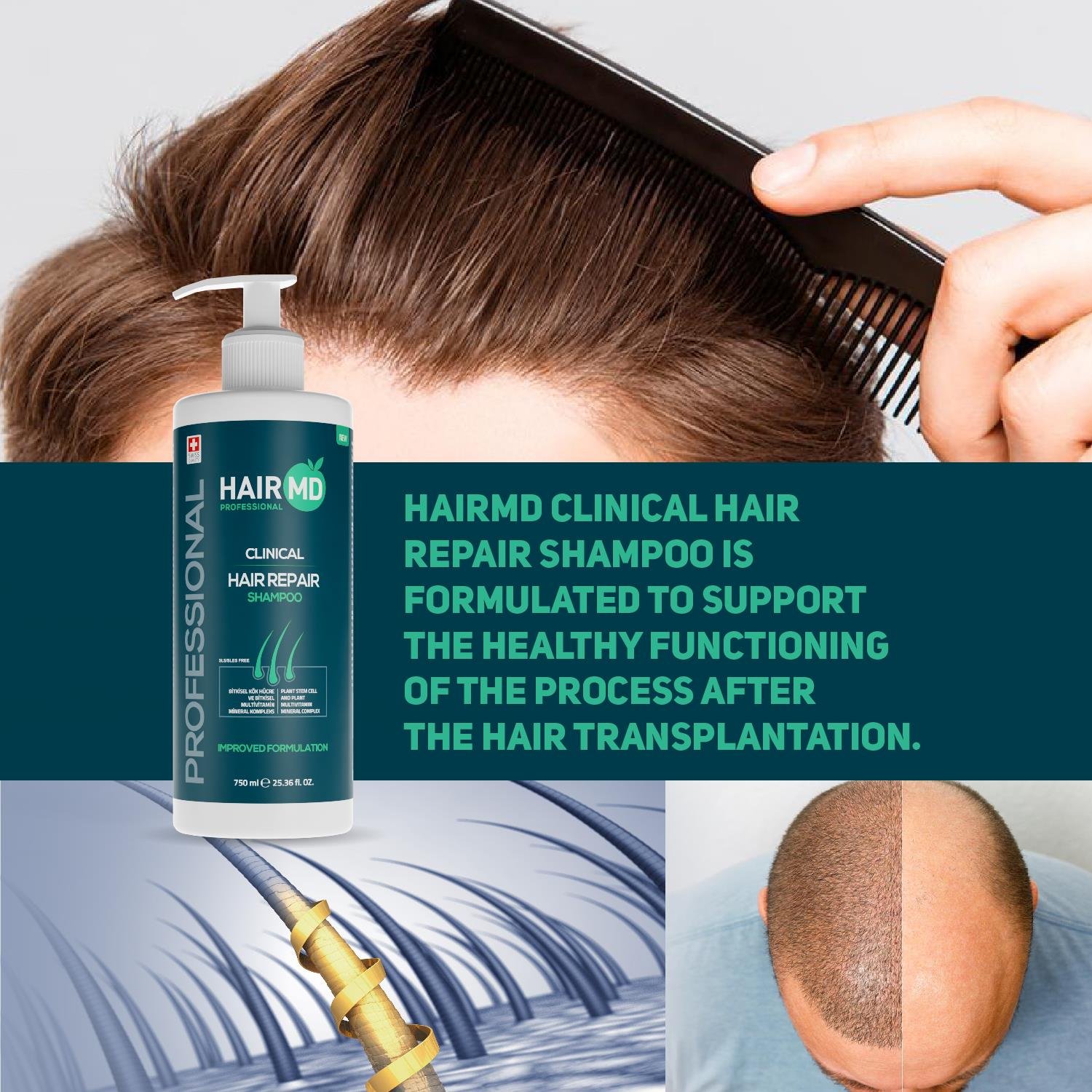 Hairmd Clinical Hair Repair Shampoo 750 Ml