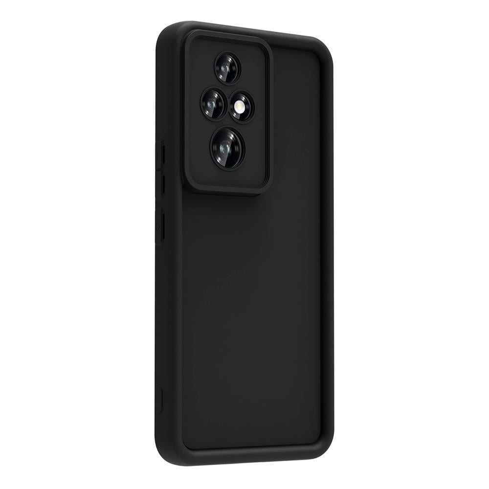 Honor 200 Pro Kılıf Kamera Korumalı Zore Ananas Kapak