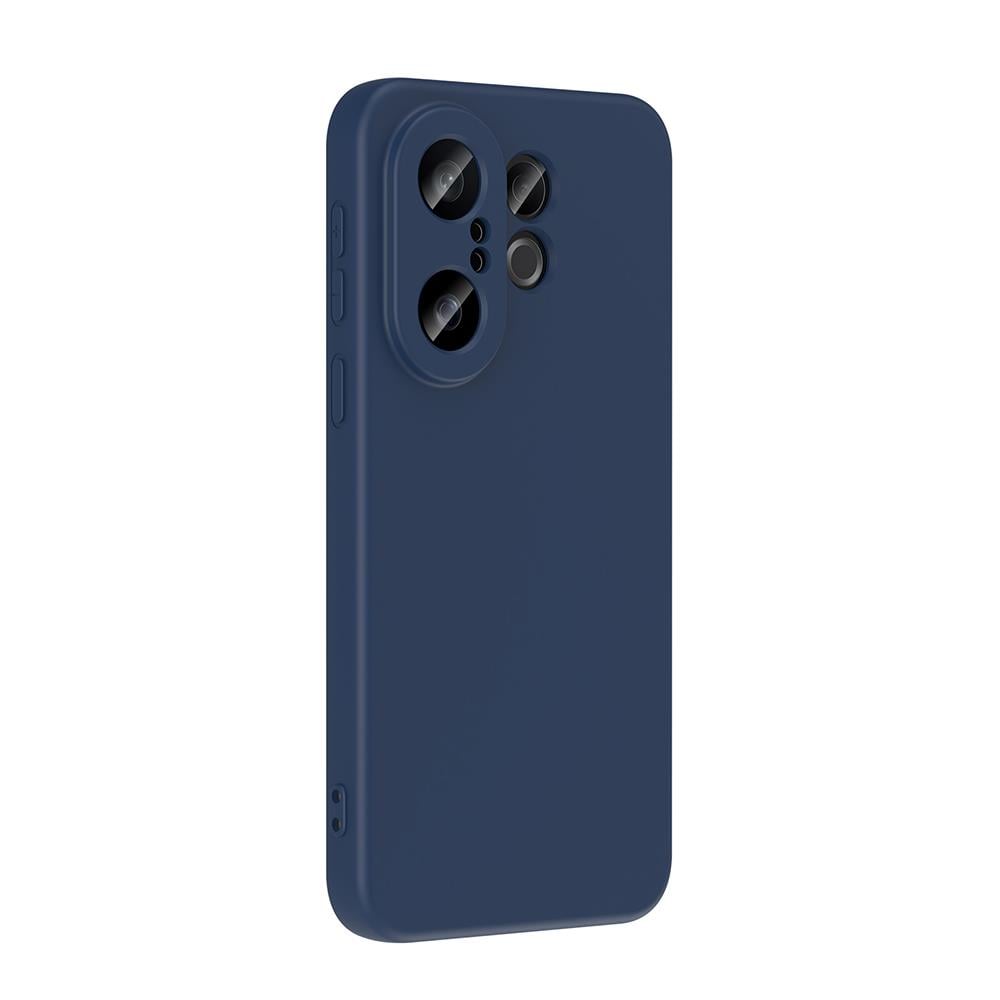 Vivo X200 FE 5G Kılıf Zore Mara Lansman Kapak