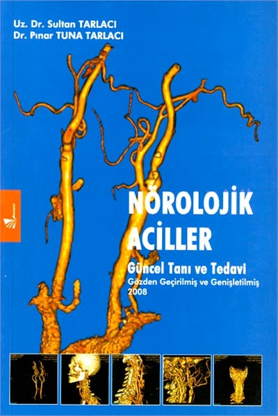 Nörolojik Aciller