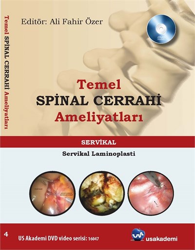 Temel Spinal Cerrahi Ameliyatları  Servikal laminoplasti