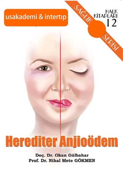 Herediter Anjioödem 