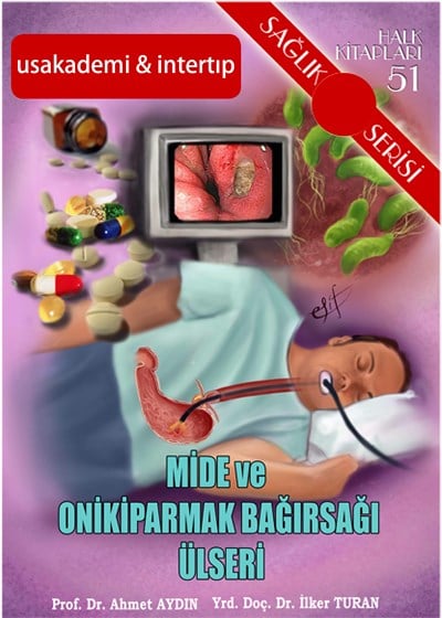 Mide ve Onikiparmak Bağırsağı Ülseri