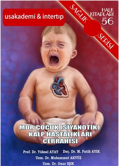 Mor Çocuk (Siyanotik) Kalp Hastalıkları Cerrahisi