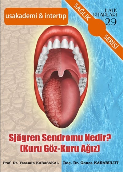 Sjögren Sendromu Nedir? (Kuru Göz-Kuru Ağız)