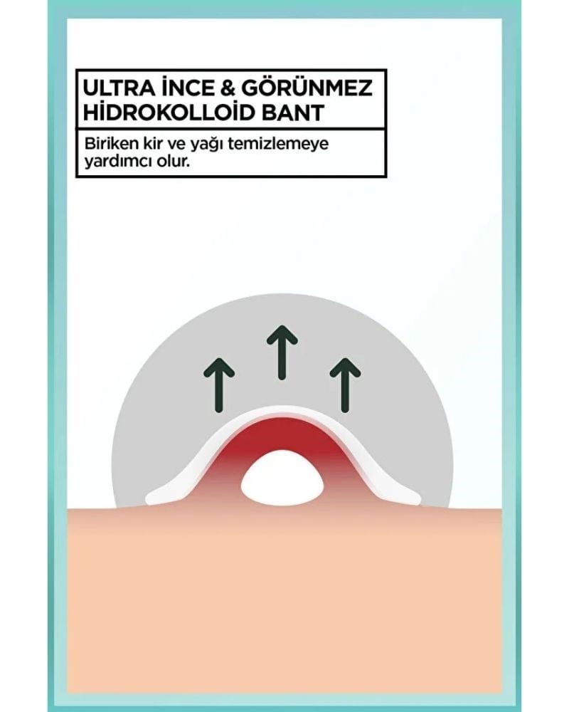 Garnier Pimple Patch 22'li Sivilce Bandı