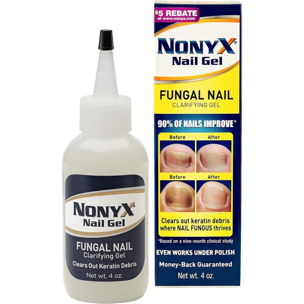 Nonyx Nail Gel 113GR