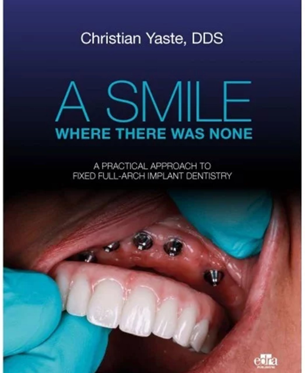 A Smile Where There Was None