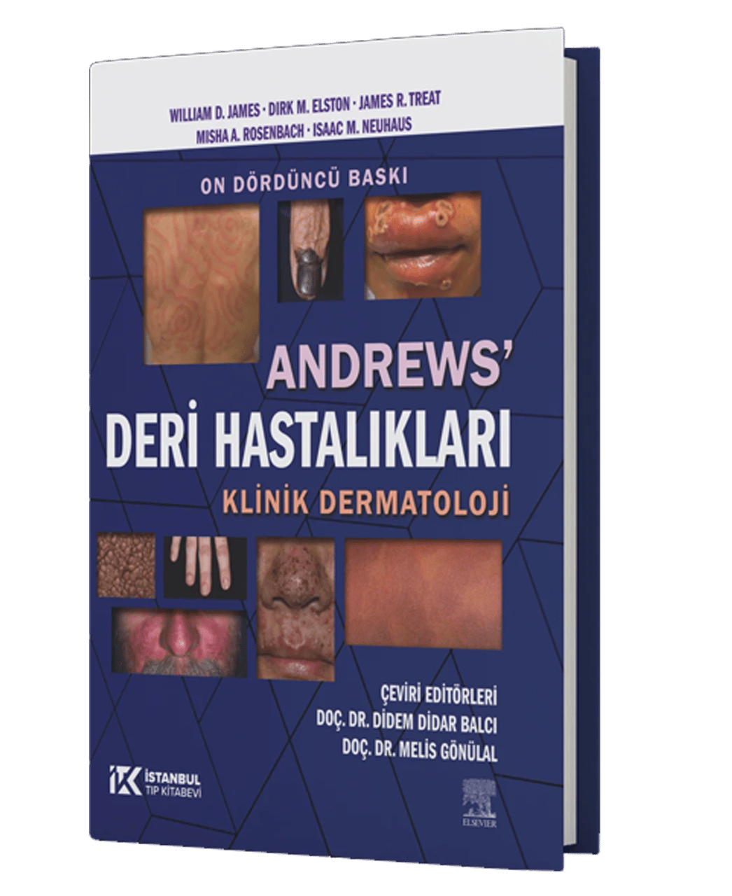 Andrews Deri Hastalıkları