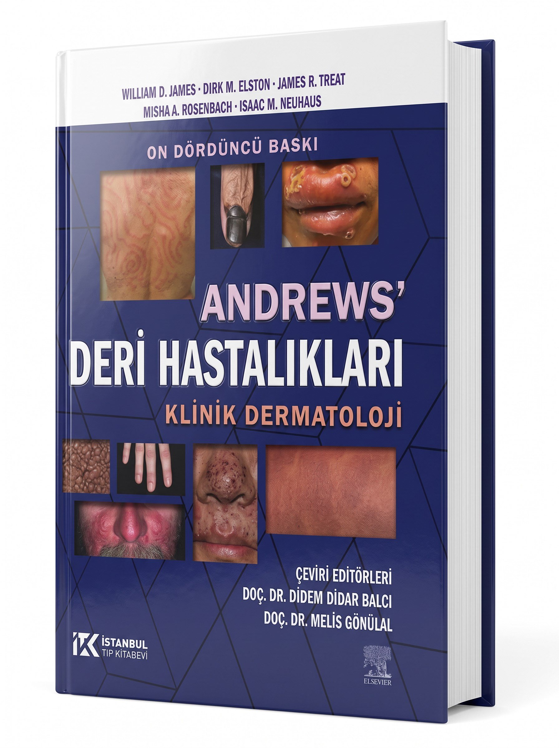 Andrews Deri Hastalıkları