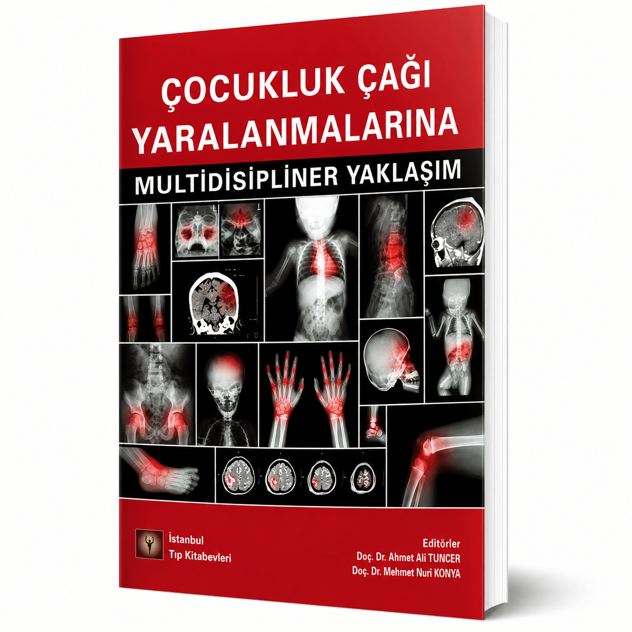 Çocukluk Çağı Yaralanmalarına Multidisipliner Yaklaşım