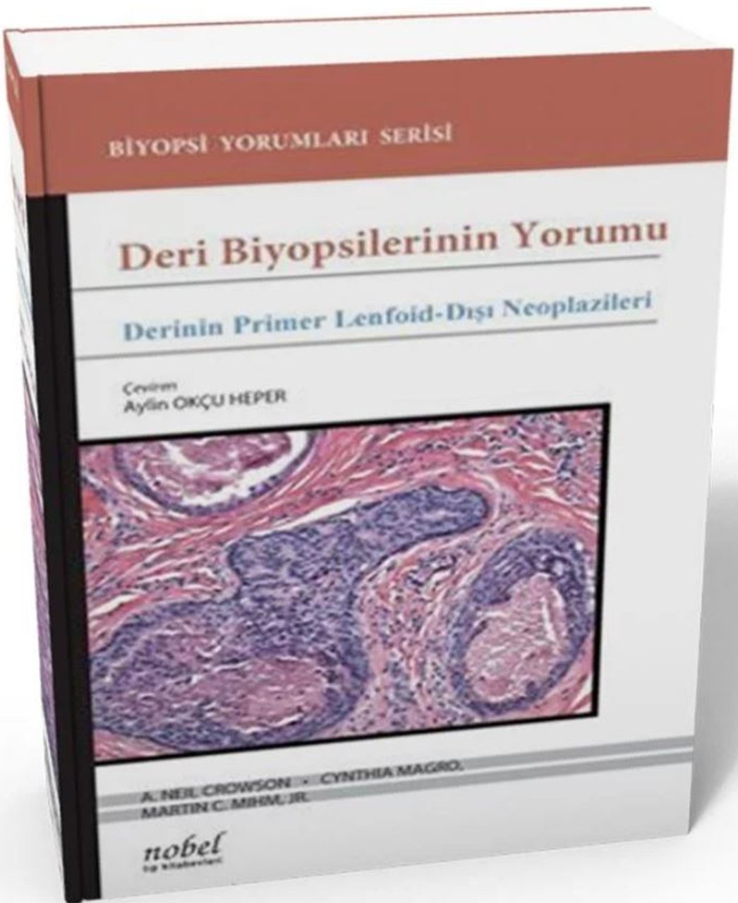 Deri Biyopsilerinin Yorumu: Derinin Primer Lenfoid-Dışı Neoplazileri