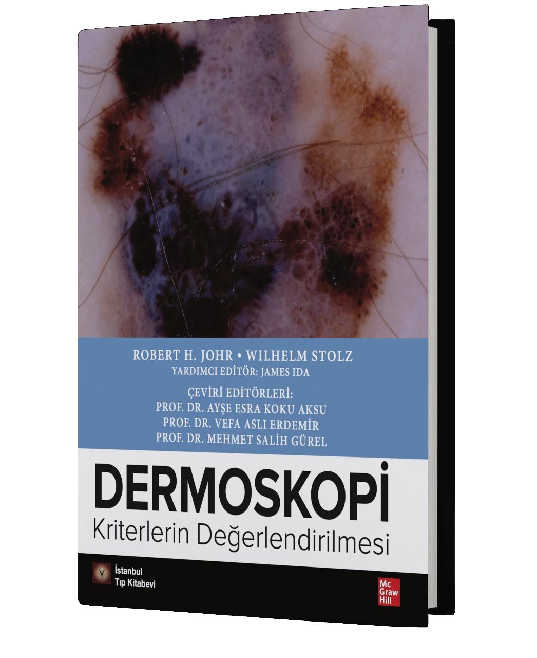 Dermoskopi Kriterlerin Değerlendirilmesi