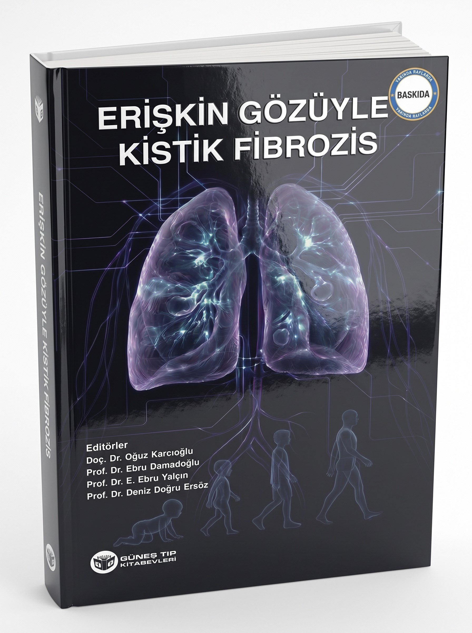Erişkin Gözüyle Kistik Fibrozis