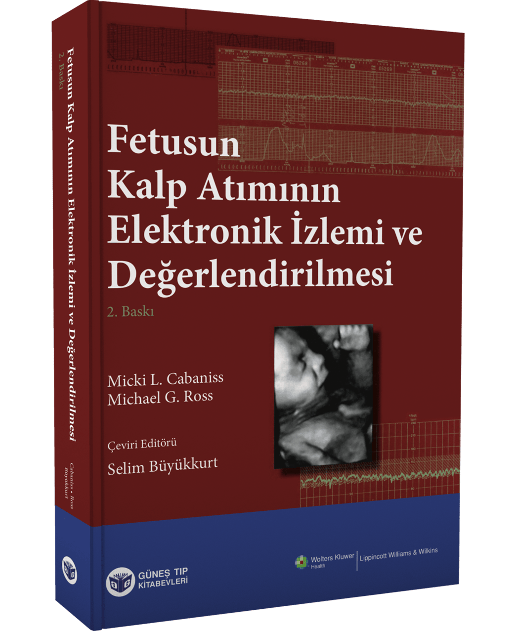 Fetusun Kalp Atımının Elektronik İzlemi ve Değerlendirilmesi
