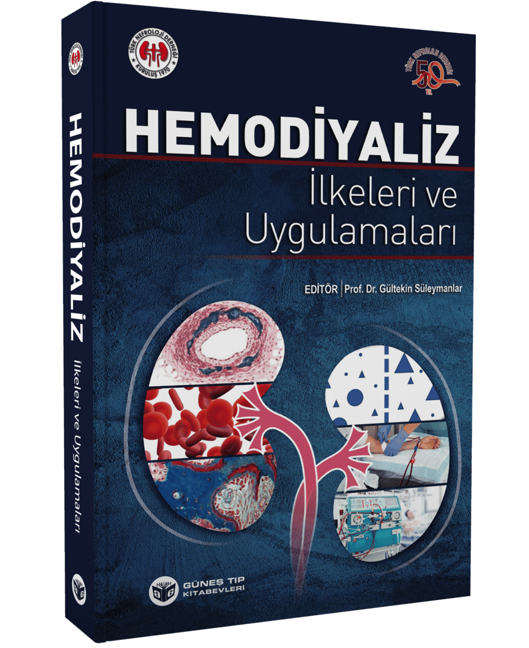 Hemodiyaliz İlkeleri ve Uygulamaları