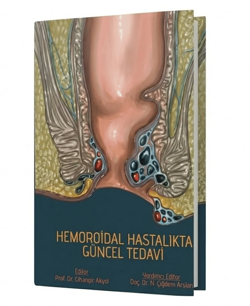 Hemoroidal Hastalıkta Güncel Tedavi