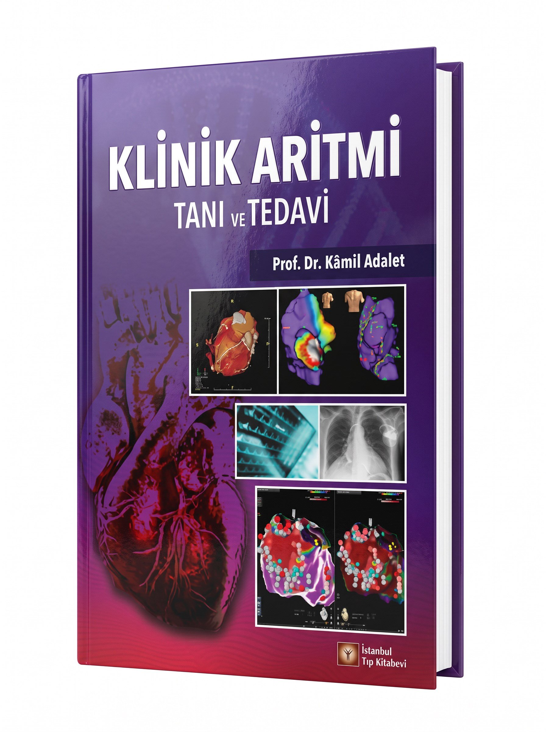 Klinik Aritmi Tanı ve Tedavi
