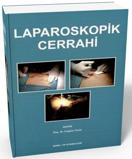 Laparoskopik Cerrahi