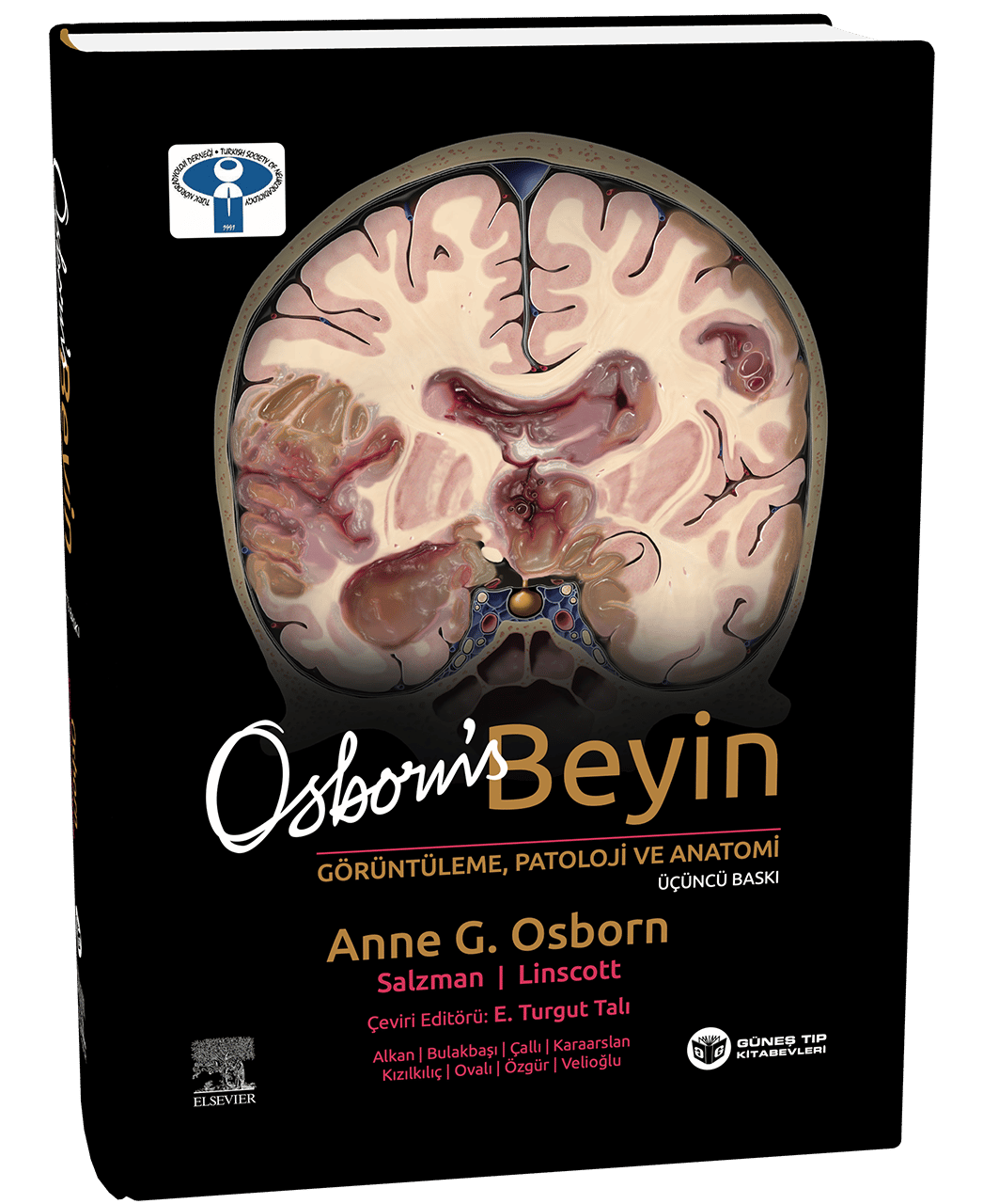 Osborn's Beyin Görüntüleme, Patoloji ve Anatomi 3. Baskı