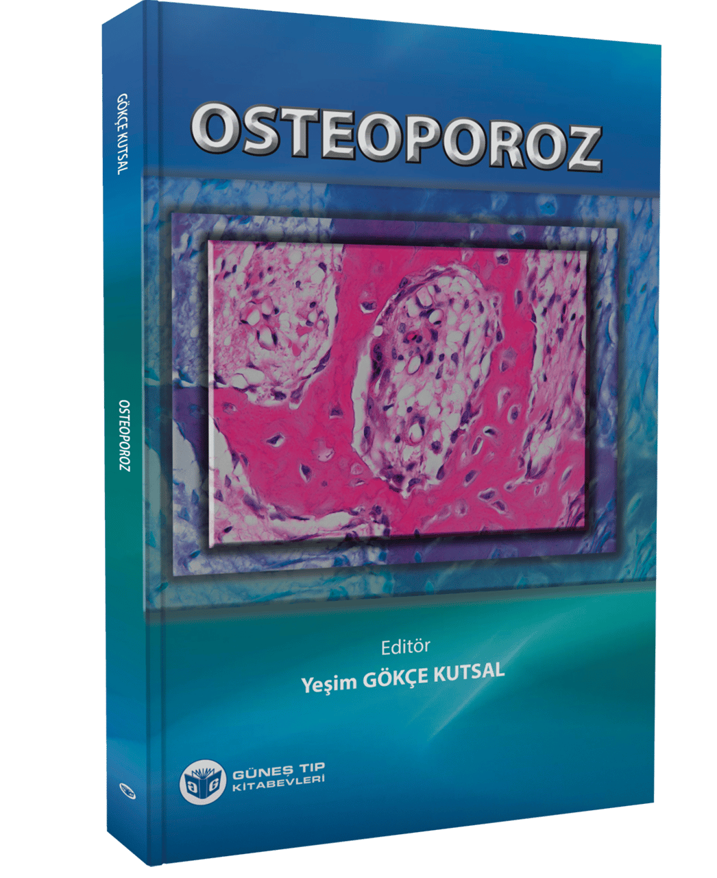 Osteoporoz