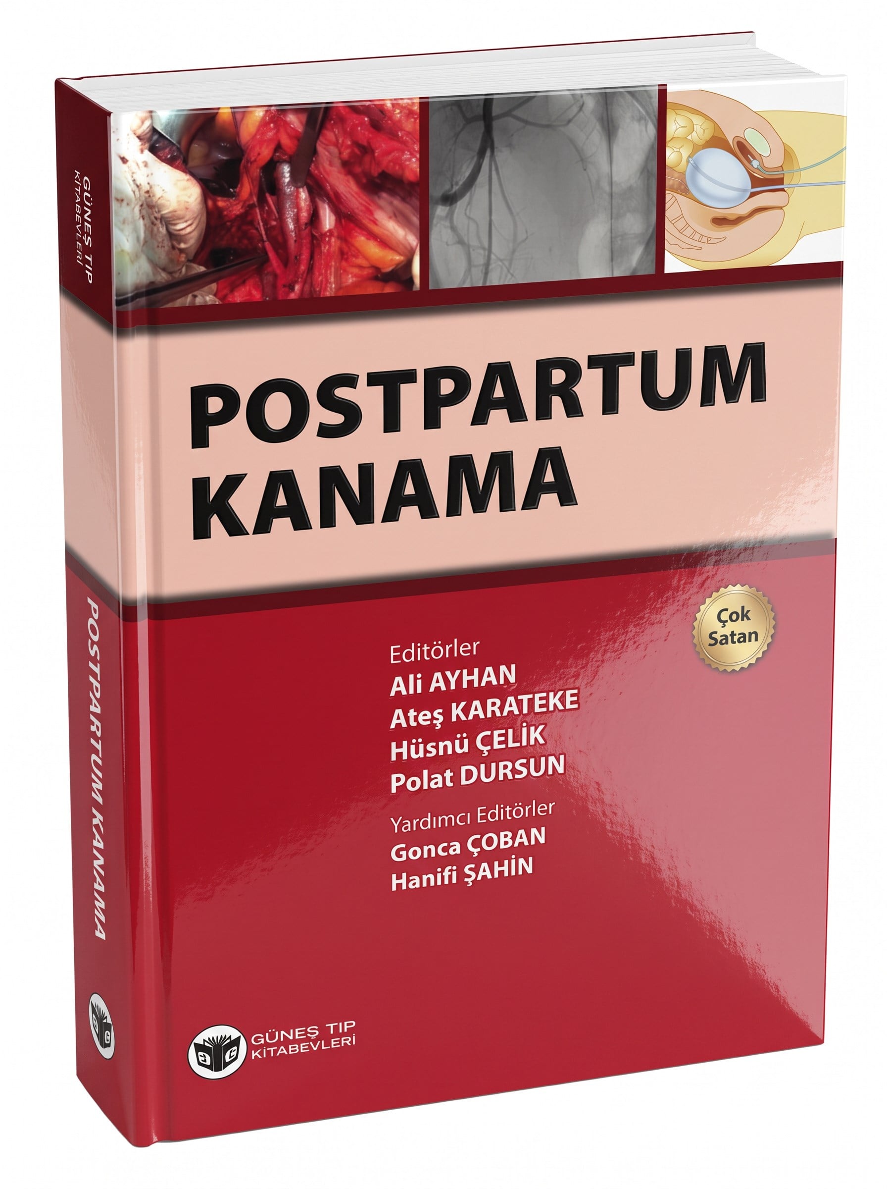 Postpartum Kanama