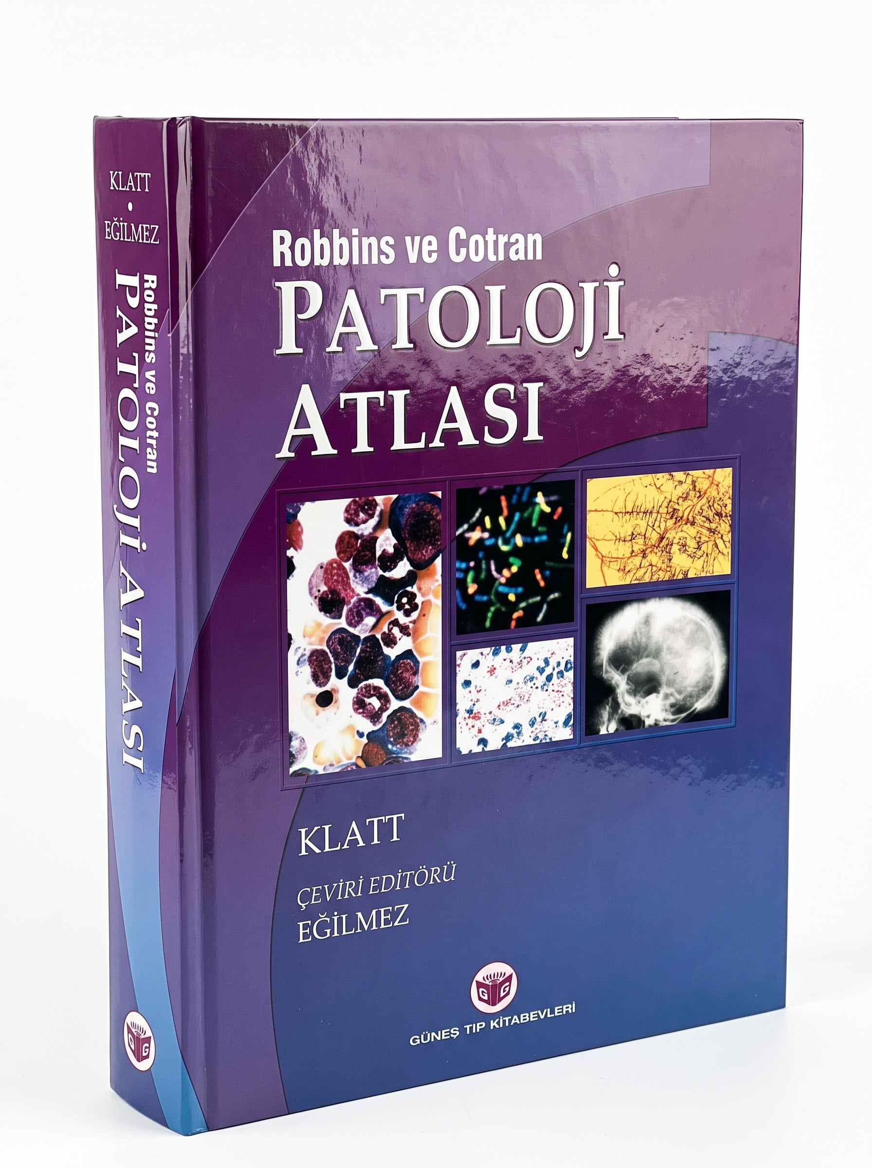Robbins Patoloji Atlası