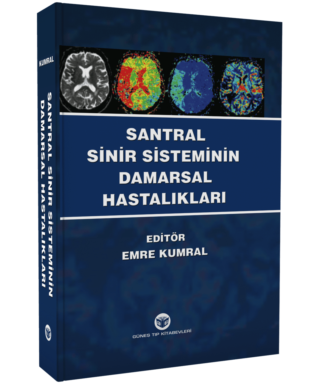 Santral Sinir Sisteminin Damarsal Hastalıkları