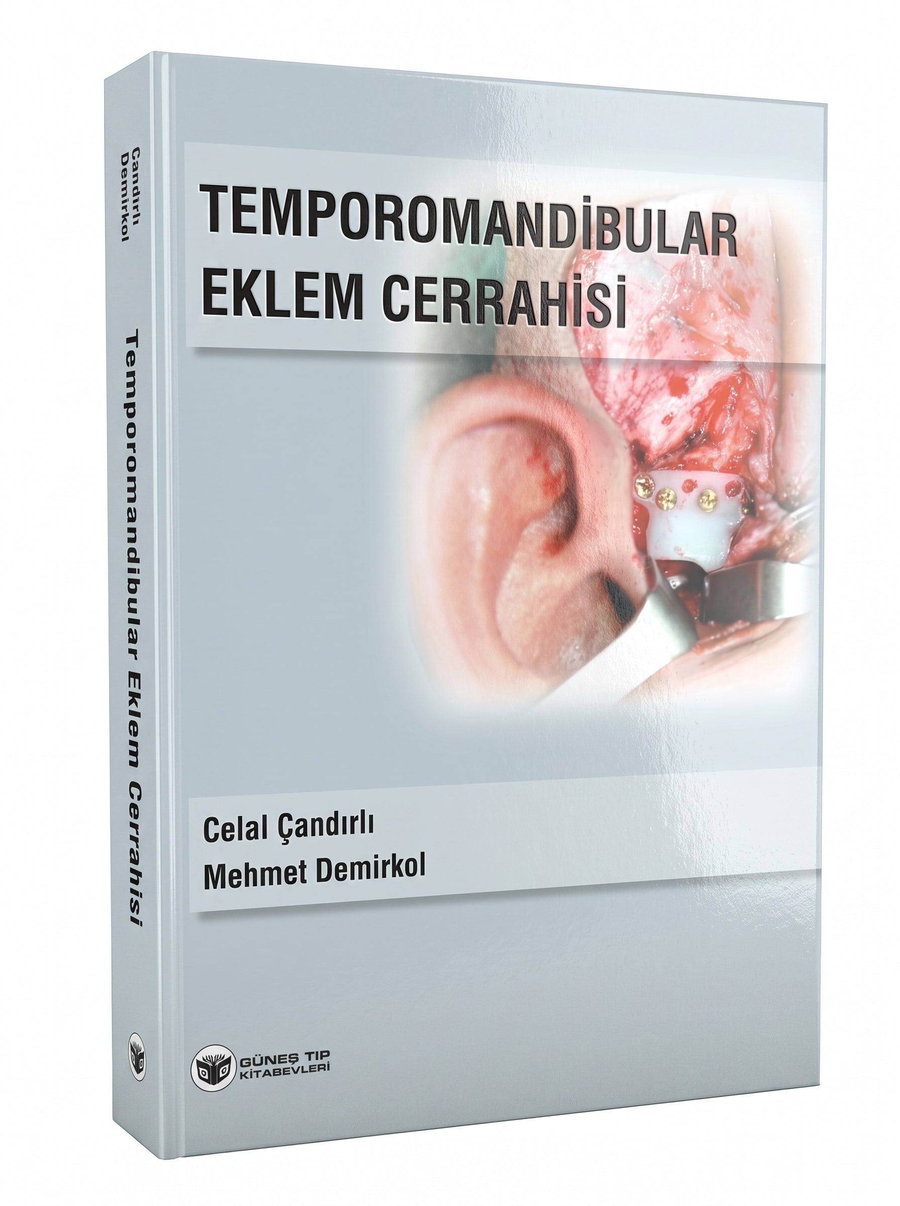 Temporomandibular Eklem Cerrahisi