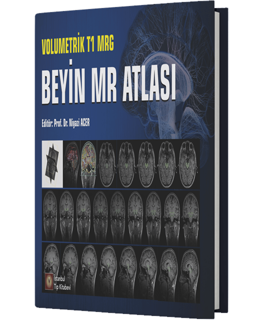 Volumetrik T1 MRG Beyin MR Atlası