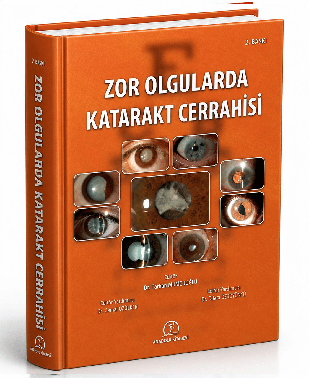 Zor Olgularda Katarakt Cerrahisi