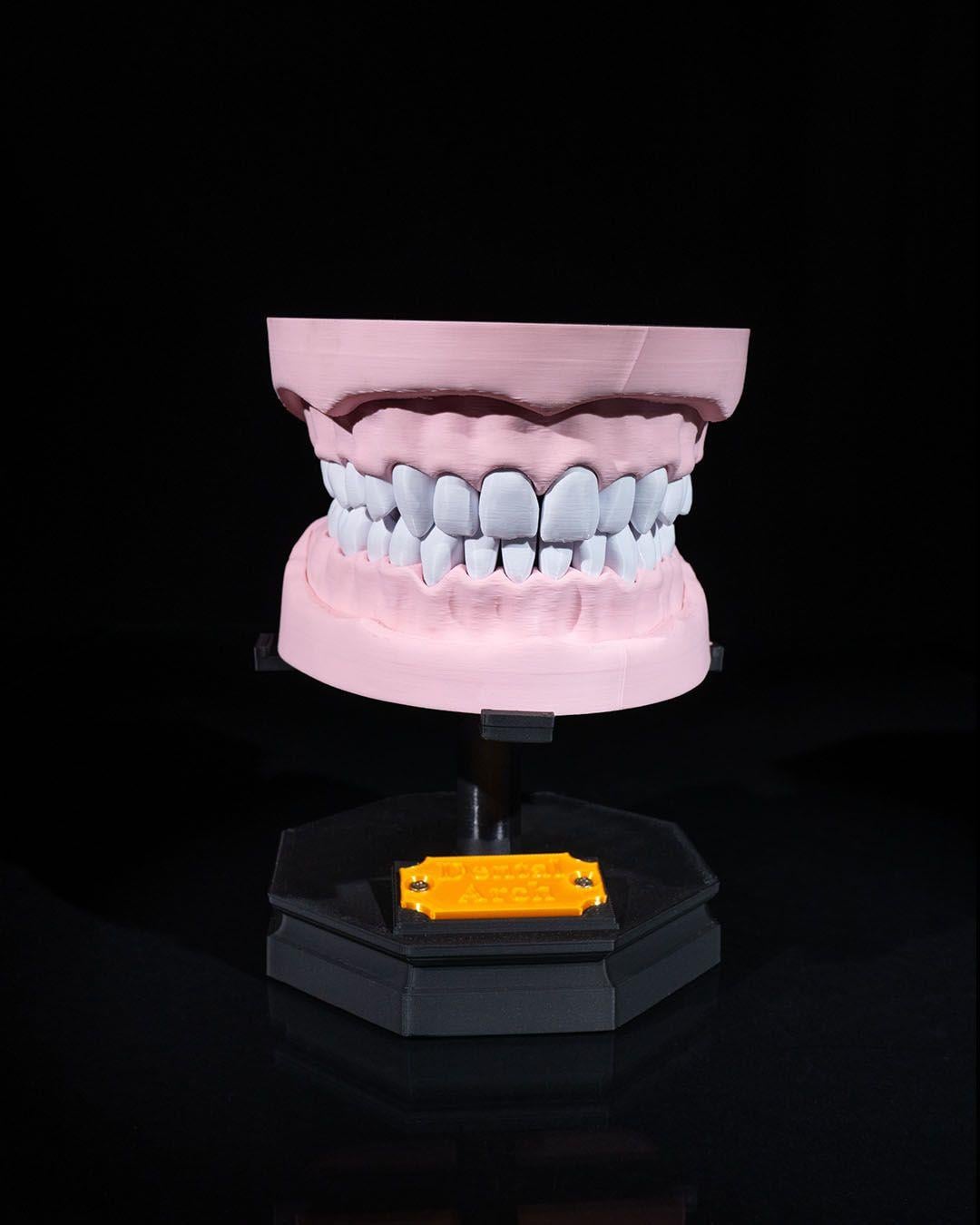 ust-ve-alt-dis-arki-modeli-8a3331.jpg